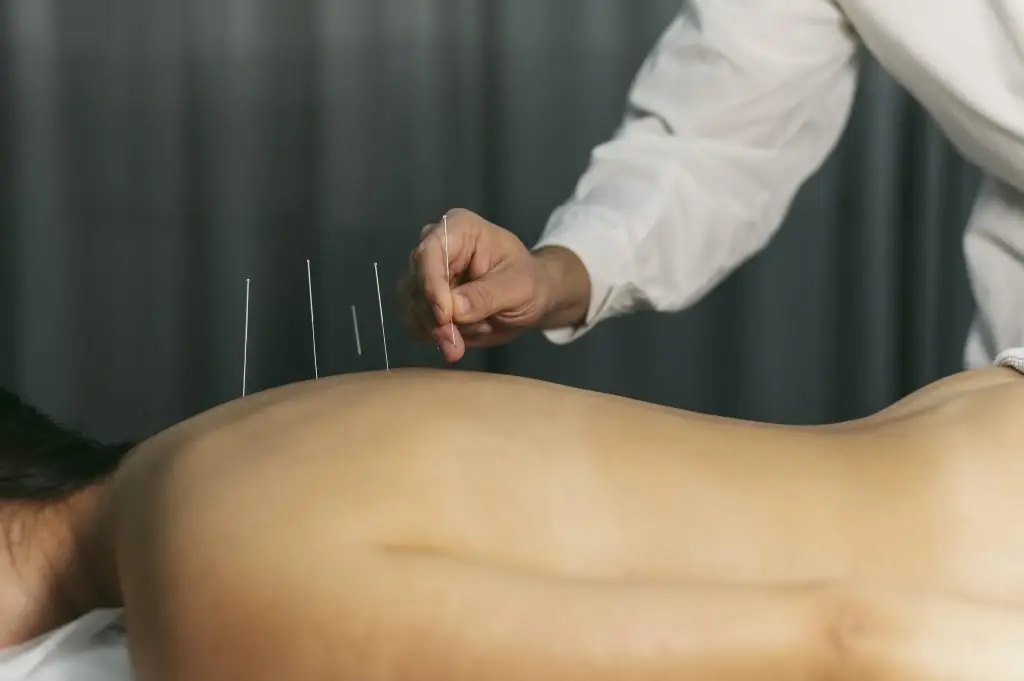 Acupuncturist in Dordrecht